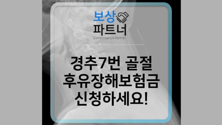 경추 7번 C7 방출성 골절 후유장해 보험금 받을 수 있어요!