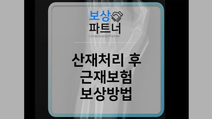 산재 후 근재보험으로 추가 보상받는 방법은?