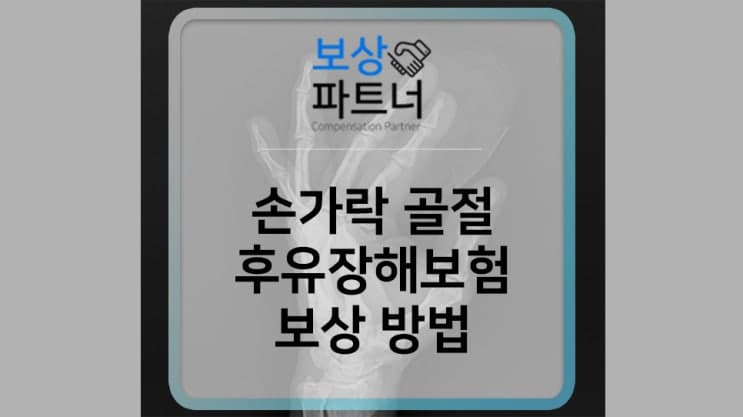 손가락 골절 후유장해 개인보험 보상받는 방법은?