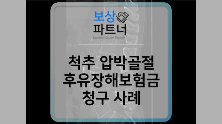 척추 압박골절 치료받았다면 후유장해 보험금 청구하세요