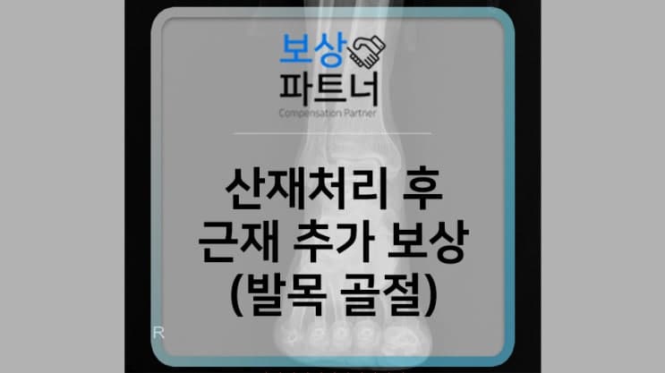 산재처리 후 근재보험까지 보상받는 방법(거골 골절)