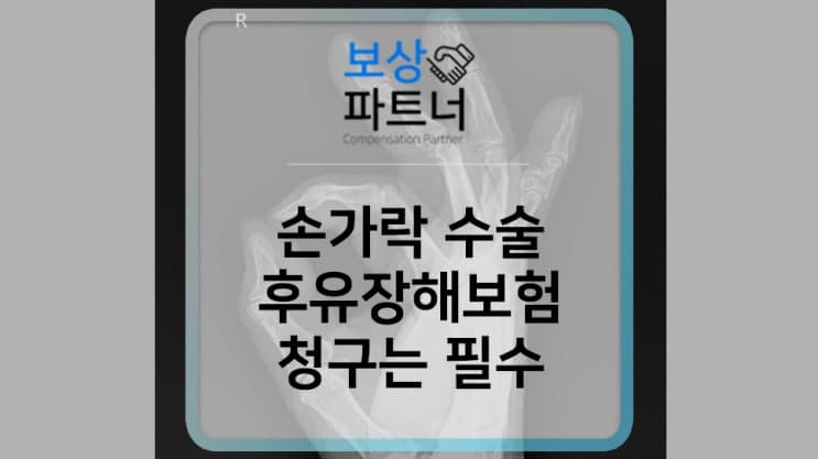 손가락골절 수술했다면 후유장해보험 청구 잊지마세요