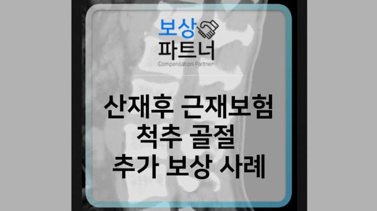 산재보상 후 놓치기 쉬운 근재보험! 척추골절 추가 보상 사례