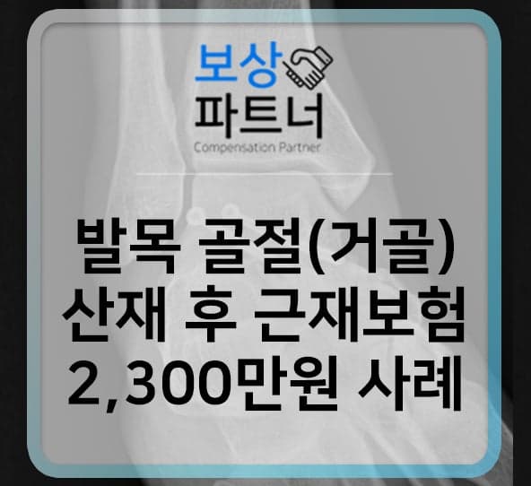 발목 골절(거골) 산재 보상 후 근재보험 청구 2,300만 원 사례