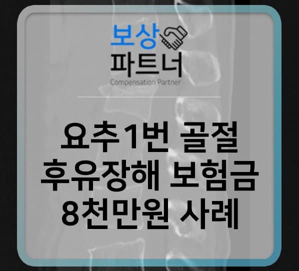 요추1번골절 척추 후유장해 손해사정 사례(8천만 원 수령)