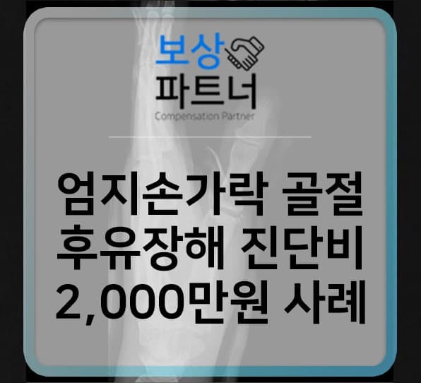 엄지손가락(1수지) 근위지골 골절, 후유장해 진단비 보상 사례